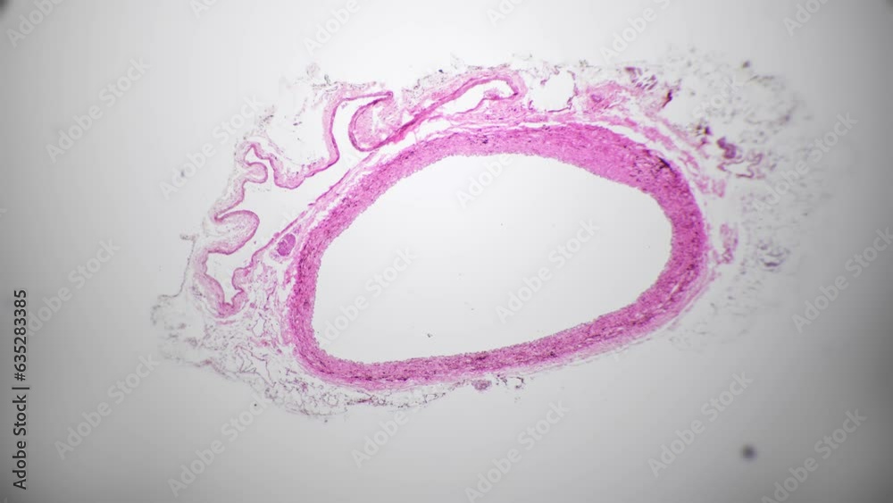 Isolated macro footage of human vein in section magnified under