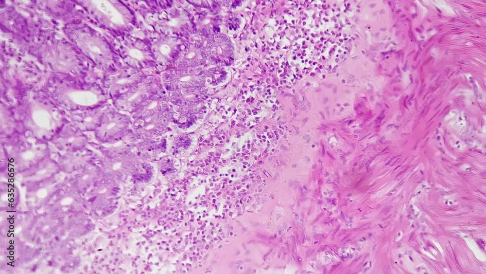 Section of human jejunum filmed under scientific microscope 200x on bright field background. Macro isolated footage of small intestine part in people body organism. Investigation of anatomy concept Section of human jejunum filmed under scientific microscope 200x on bright field background. Macro isolated footage of small intestine part in people body organism. Investigation of anatomy concept