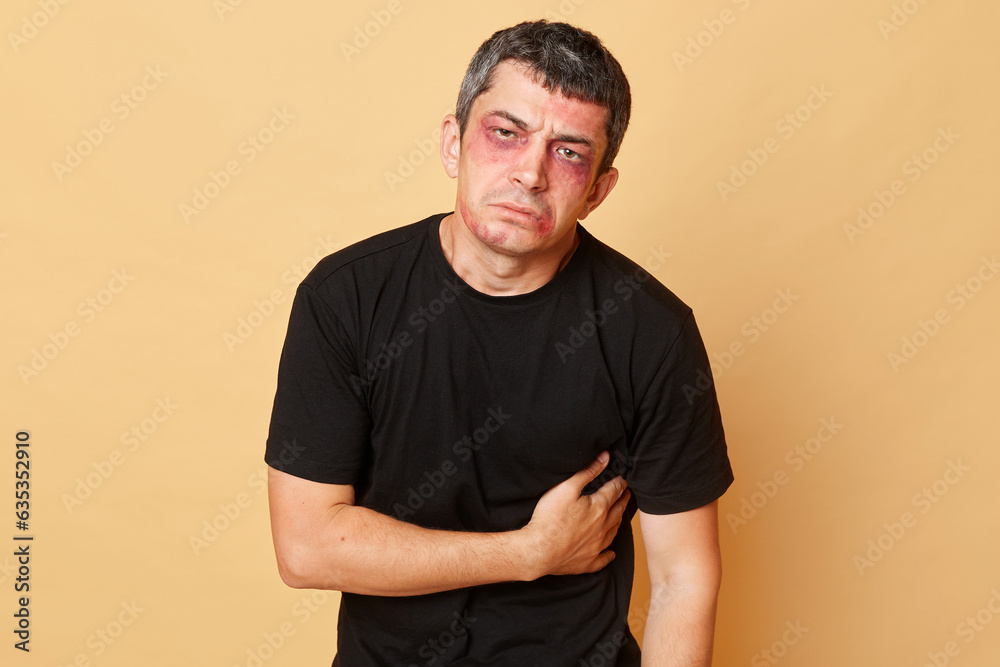 Φωτογραφία Injured man in black T-shirt victim of violence with bruises and abrasions on his face isolated over beige background touching his stomach  feeling pain grimacing looking at camera