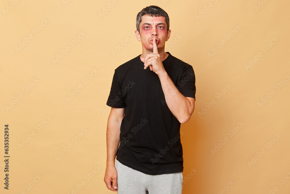 Φωτογραφία Calm sad man in black T-shirt with bruises and abrasions on his face isolated over beige background standing with finger near lips keeps secret about violence