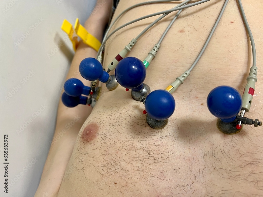 diagnoses heart disease cardiogram ECG or EKG of heart with electrodes