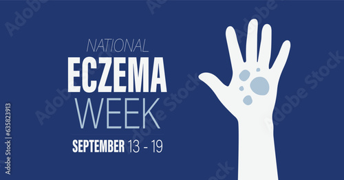 National Eczema Week. September 13 - 19, 2023 vector awareness campaign banner. © Carl