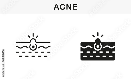 Deep Dirty Pore, Skin Problem Symbol Collection. Skin Acne, Blackhead, Comedo Line and Silhouette Black Icon Set. Pimple and Inflammation Sebum Pictogram. Isolated Vector Illustration