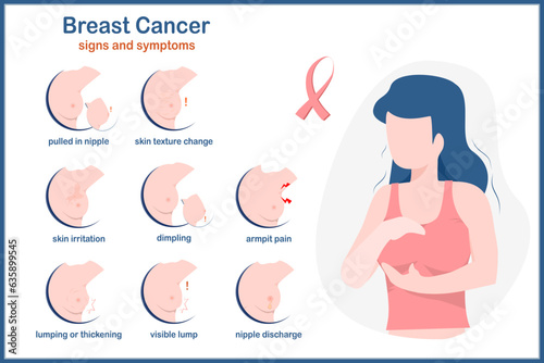 Medical illustration.Vector infographic of symptoms of breast cancer.pulled in nipple,armpit pain, dimpling,lumping or thickening,skin irritation.flat style.isolated on white background. photo