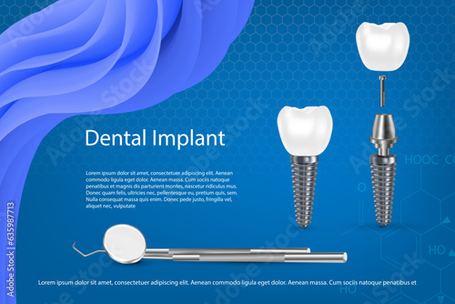 Human teeth and Dental implant Vector Illustration.