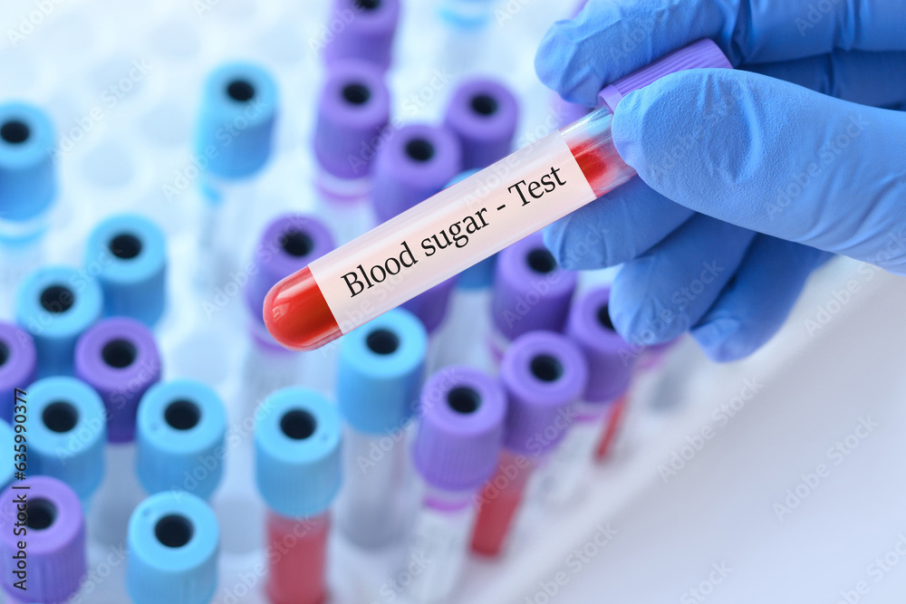 Obraz premium Doctor holding a test blood sample tube with Sugar test on the background of medical test tubes with analyzes.Copy space for text