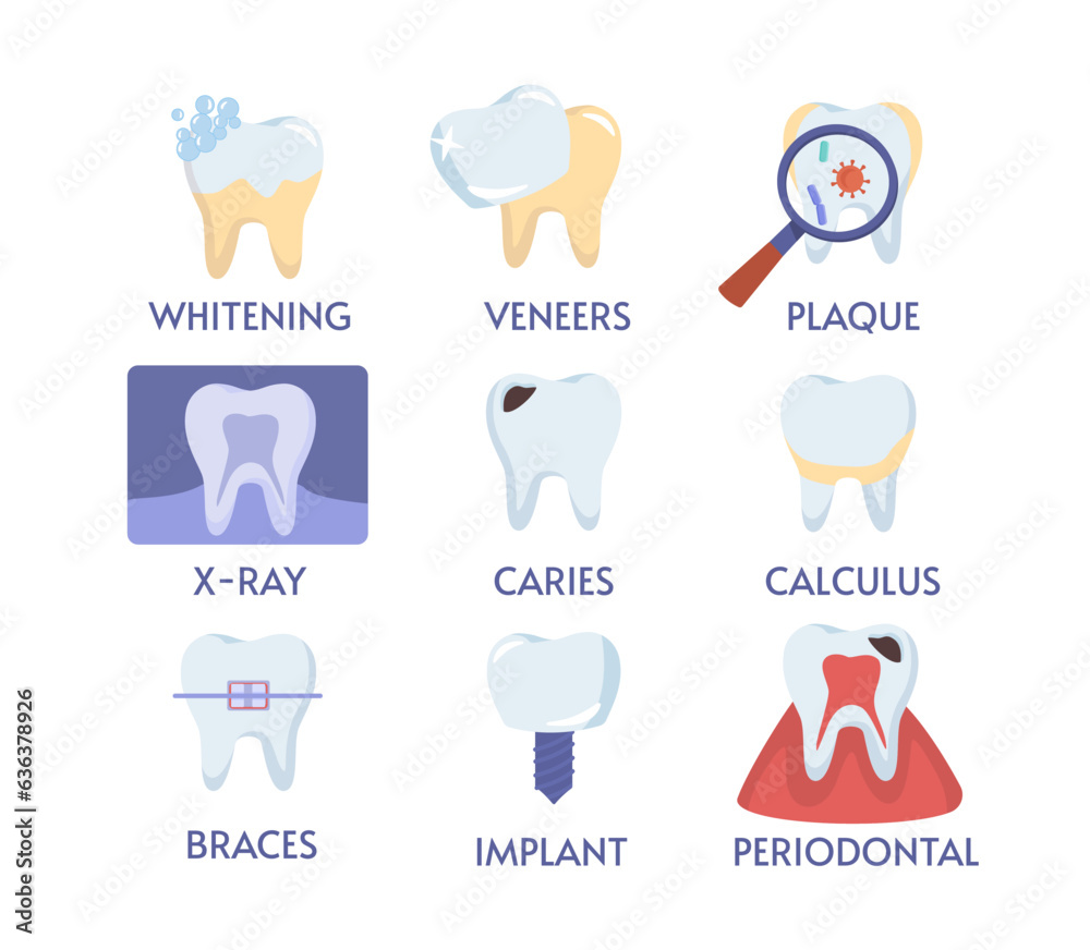 Set of teeth procedures. Medical infographics and materials. Caries, calculus, implant and braces. Oral hygiene and dentistry. Cartoon flat vector collection isolated on white background Set of teeth procedures. Medical infographics and materials. Caries, calculus, implant and braces. Oral hygiene and dentistry. Cartoon flat vector collection isolated on white background
