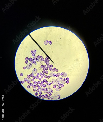 Cells in Gastrulation photo