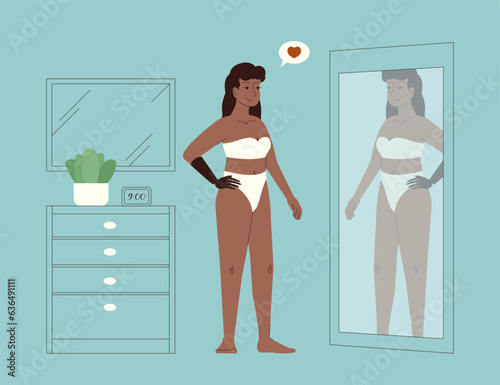 Lady with prosthetic hand looking in mirror vector illustration.