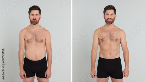 Collage with portraits of man before and after weight loss on light background photo