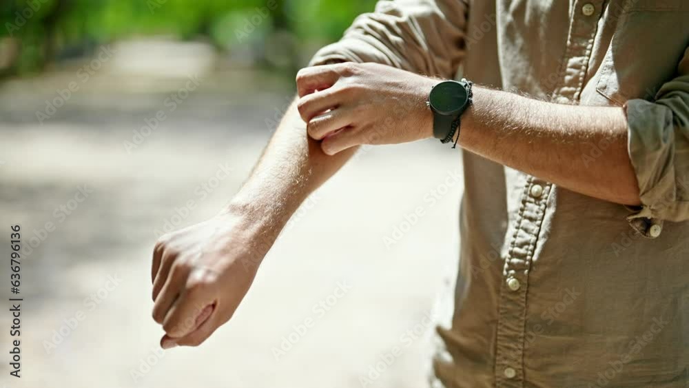 Young hispanic man scratching arm at park