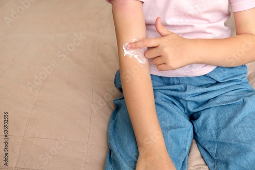 The child applies a special cream to atopic skin. Dermatitis, diathesis, allergy on the child's body.	