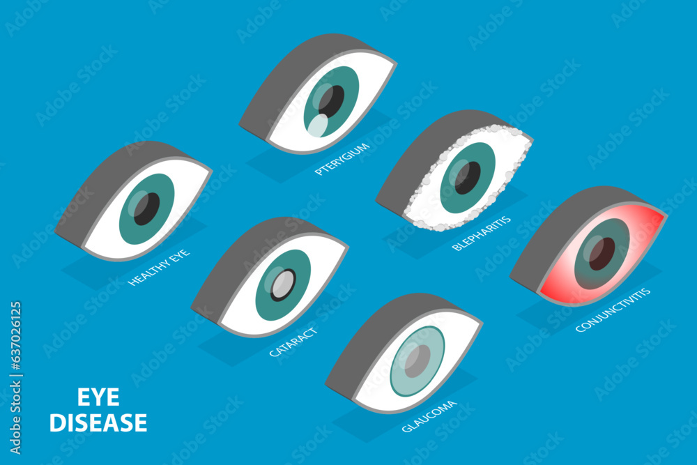 Eye Problem Graphicsgraphics 3D Isometric Flat Vector Set of Eyes with Different Problems, Human Eye ...