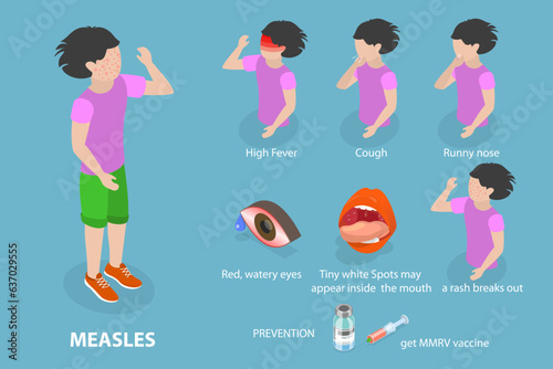 3D Isometric Flat Vector Conceptual Illustration of Measles, Red Rash