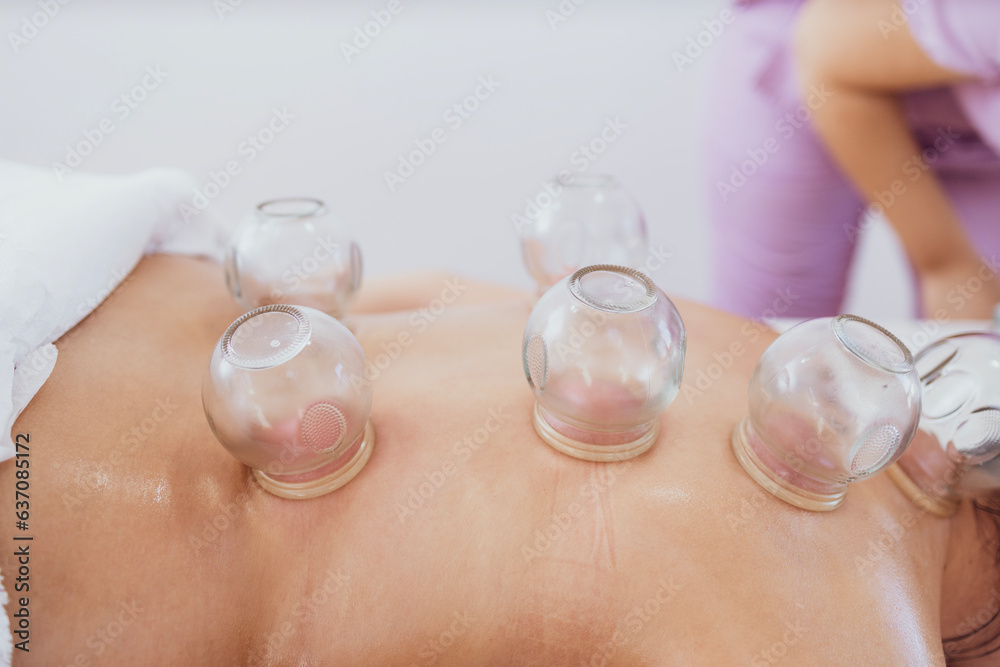 Professional female therapist doing hijama treatment on patient back. Putting heated vacuum cups to heal chronic pain. Professional female therapist doing hijama treatment on patient back. Putting heated vacuum cups to heal chronic pain.