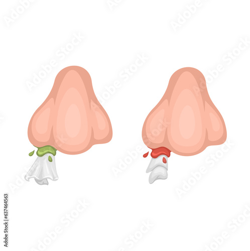 Runny Nose And Nosebleed with Tissue Symbol Cartoon illustration Vector