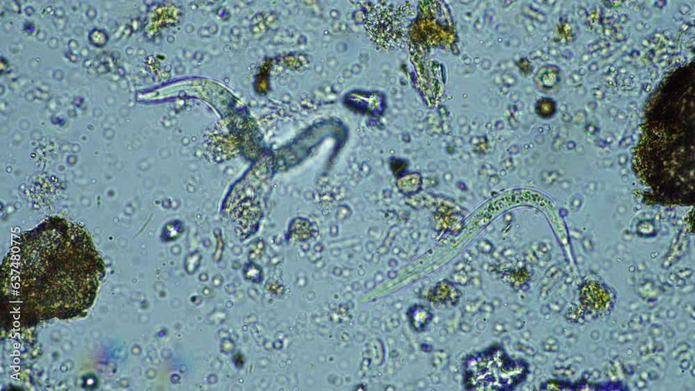microorganisms close up under the microscope. in a soil sample from a farm microorganisms close up under the microscope. in a soil sample from a farm