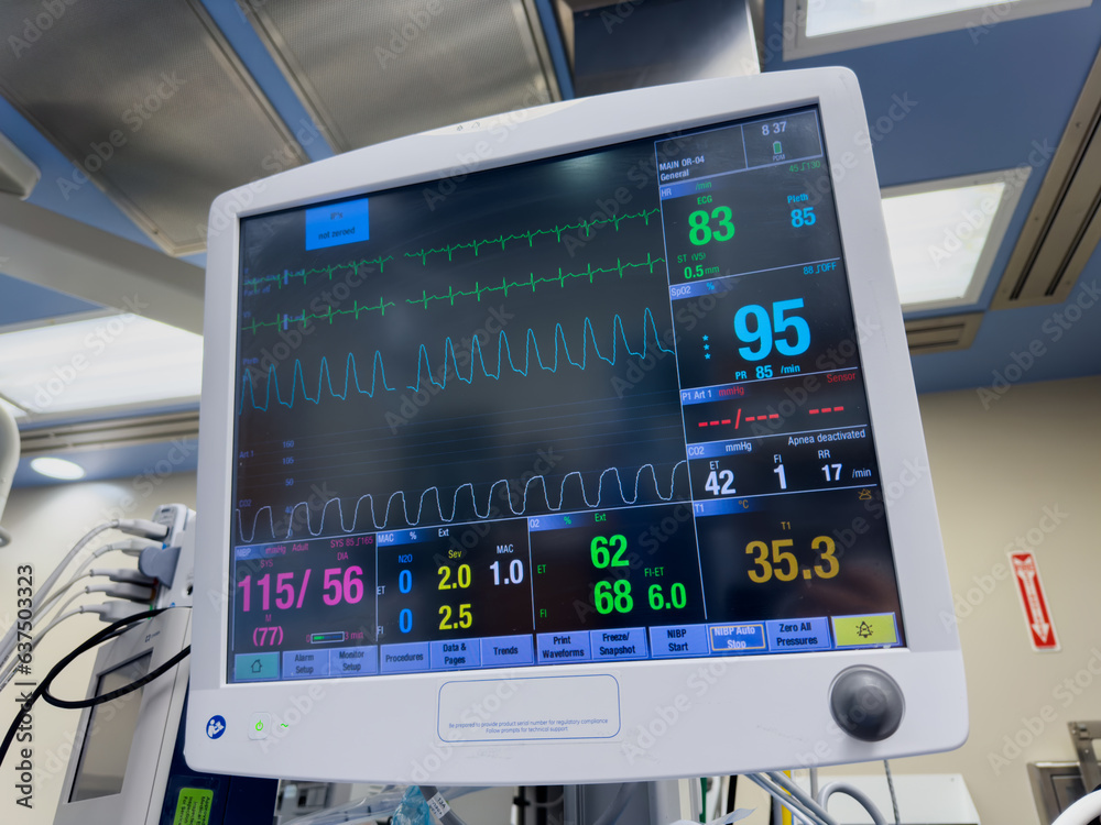 Hospital monitor displays vital signs: heart rate, blood pressure, and ...