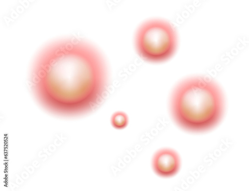 Acne skin pimple