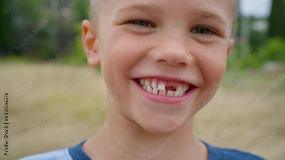 A boy without a front tooth smiles, laughs and rejoices, experiencing positive emotions, taken in close-up. A boy without a front tooth smiles, laughs and rejoices, experiencing positive emotions, taken in close-up.