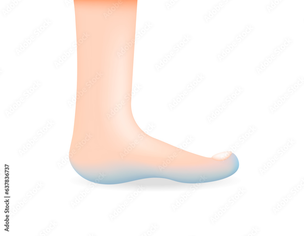cold feet illustration. feeling cold on the soles of the feet. tingling
