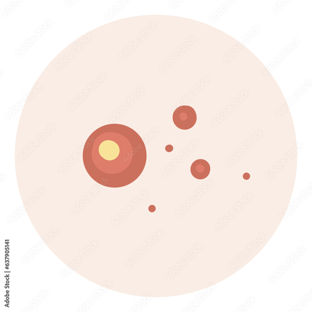 Fototapeta premium type face skin acne, pimples, blackheads illustration. Acne skin face problem