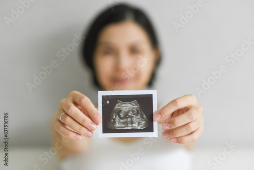 Happy Young Pregnant woman holding showing ultrasound scan photo. Smiling Asian Mother with sonogram of her unborn baby. Concept of pregnancy, Maternity prenatal care photo