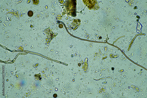 arcella, fungi and nematode in a soil sample on a farm photo