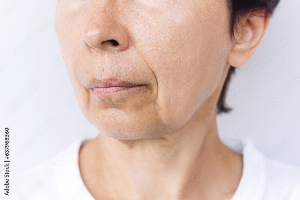 Obraz premium The lower part of elderly woman's face and neck with signs of skin aging isolated on a white background. Age-related changes, flabby sagging facial skin, wrinkles and creases. Aging process