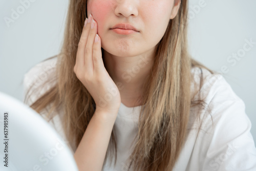 Young woman asian are worried about faces Dermatology and allergic to steroids in cosmetics. sensitive skin, red face from sunburn, acne, allergic to chemicals, rash on face. skin problems and beauty