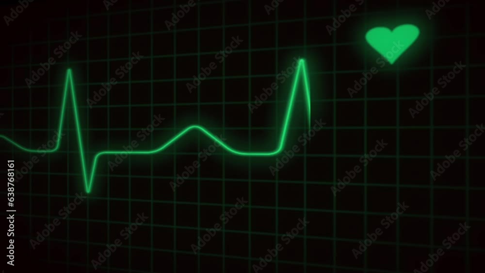 EKG - Heartbeat Display Monitor - Loopable Animation