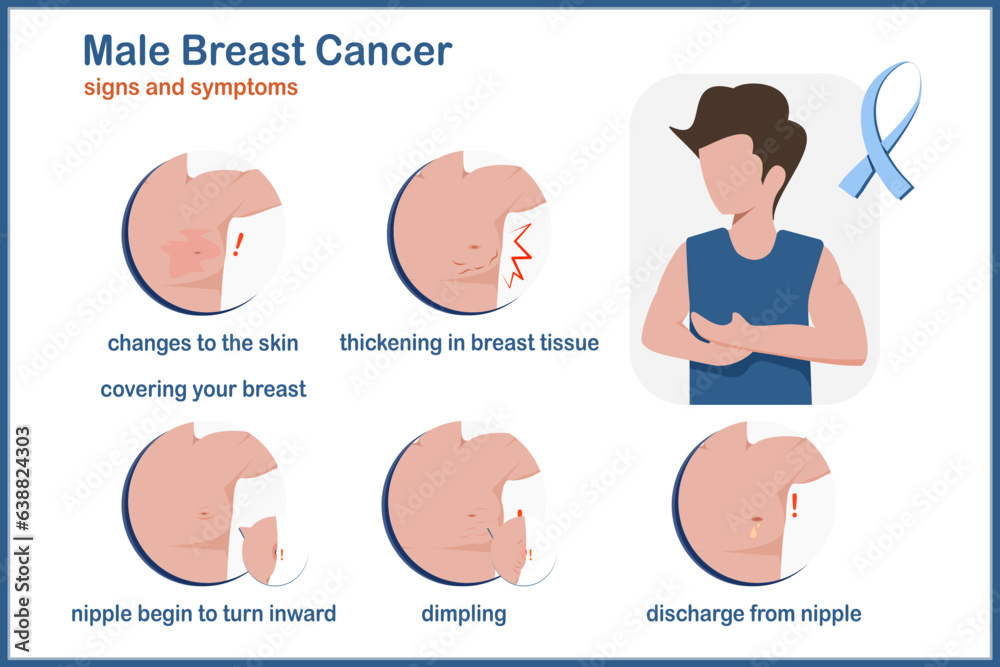 Medical vector illustration.Symptoms of breast cancer in males
