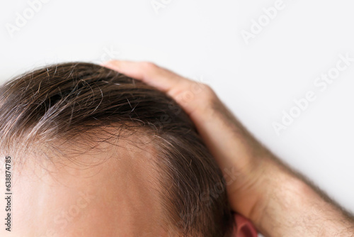 Man touching her hair close up on white background, hair loss concept.
