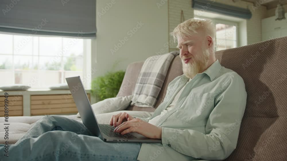 Albino man relaxing on sofa at home, communicating via video link on laptop. Albino man waves hello, having pleasant talk through video, sitting on sofa. High quality 4k footage Albino man relaxing on sofa at home, communicating via video link on laptop. Albino man waves hello, having pleasant talk through video, sitting on sofa. High quality 4k footage