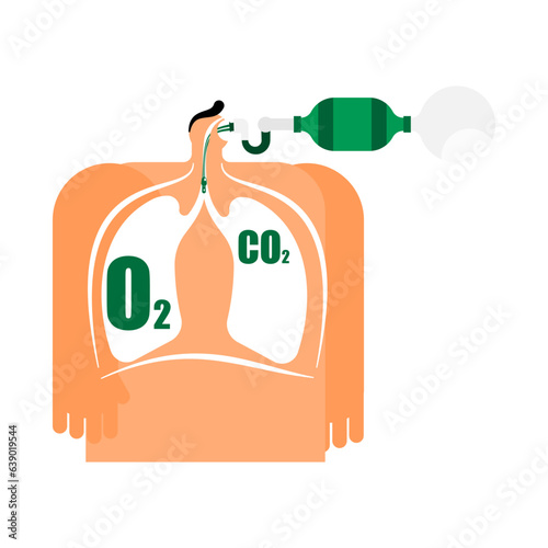 Cartoon characters for advanced airway and ventilation procedure. 