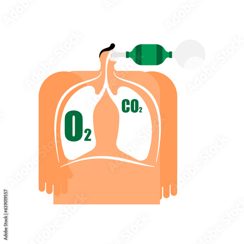 Illustration of the breathing and ventilation, resuscitation by holding a mask of bag-vale-mask ventilation.
