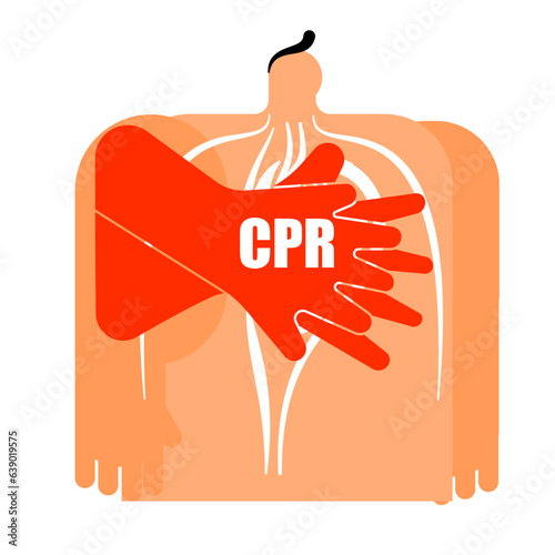 Illustration of basic CPR, chest compressions, external cardio massage.