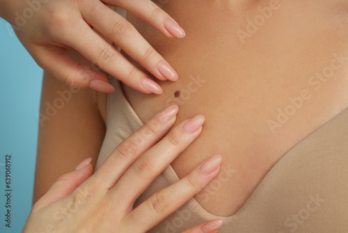Dermatologist examining young woman's mole on blue background, closeup