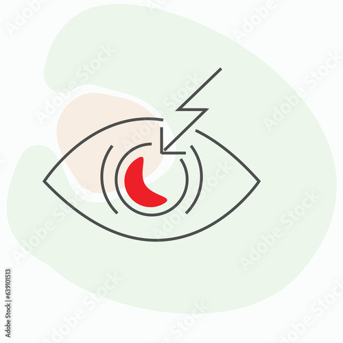 Lens implants, also known as intraocular lenses (IOLs), are artificial lenses that are used to replace the natural lens of the eye during cataract surgery or in some cases, as a corrective measure for