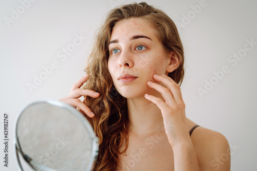 Beautiful woman with problematic skin looks in her small mirror. Cosmetology. Skin care concept. photo