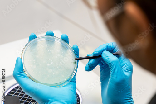 Scientist analysis and cultivate bacteria molds and fungal testing clinical samples, cultured in petri dish. Growth media to isolate total fungal by using colony counter in laboratory.