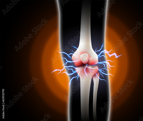 Knee pain and pain in the bones Arthritis of the knee on black background. Realistic 3d vector file.