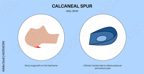 Orthotic shoe and insoles