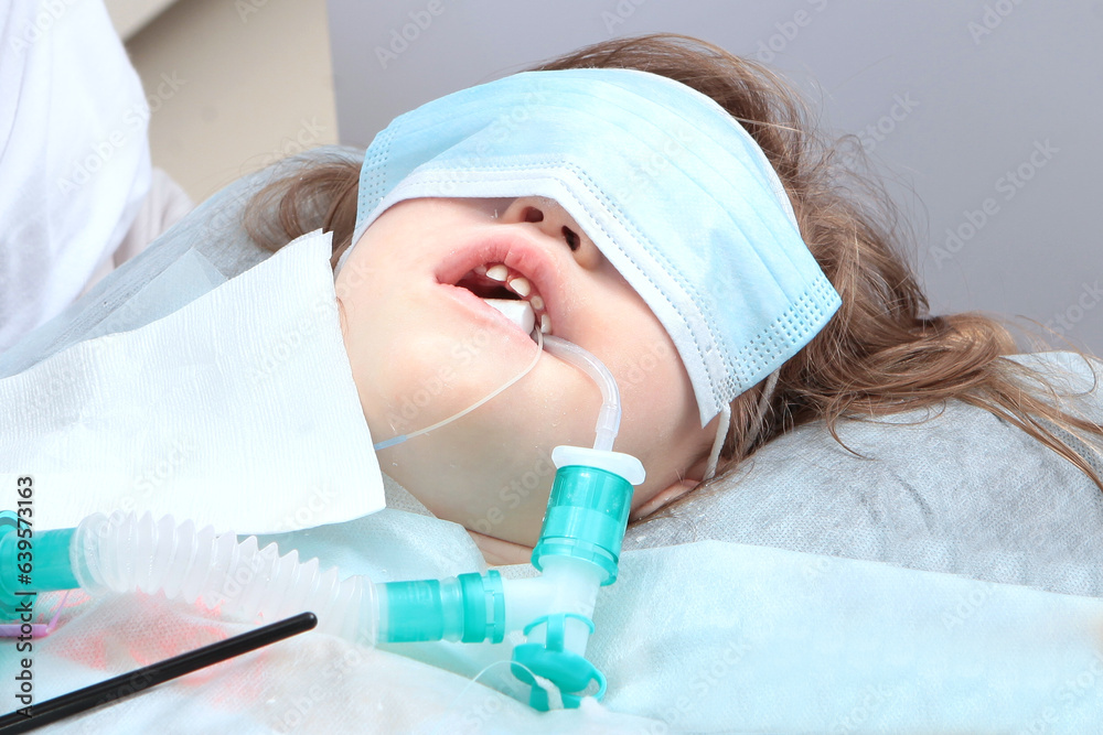 Child is under anesthesia. Breathing tube in mouth. Treatment of baby