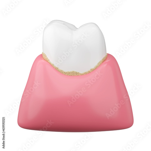 Fotografie White teeth and tartar with pink gums for dental calculus for oral hygiene concept
