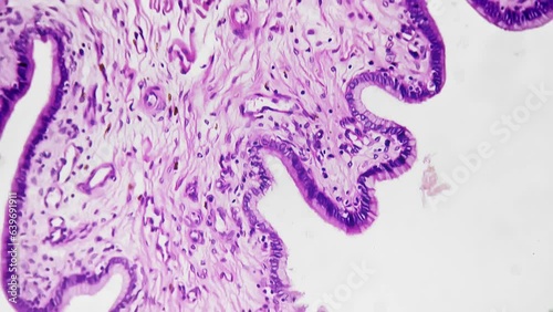 Microscopic magnification of a specific section of the human vagina with a 200x zoom against a bright field background. Study of female reproductive system in gynecology. Examination of tissue samples photo