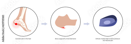 Orthotic shoe and insoles