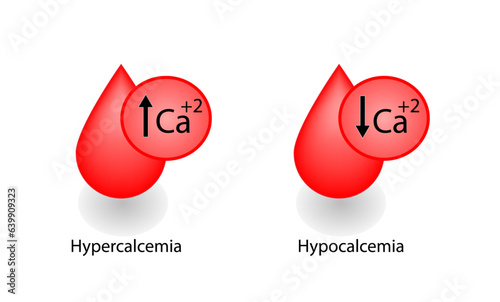 Hypercalcemia, high plasma calcium level and hypocalcemia, low plasma calcium level. Calcium excess and deficit electrolyte disorders, blood droplet, Scientific design. Vector illustration.