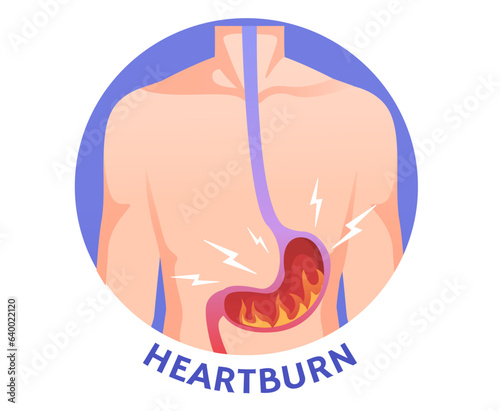 Man with heartburn concept. Medical educational materials and infographic. Young guy with pain in stomach. Character with problems with disgestive system. Cartoon flat vector illustration