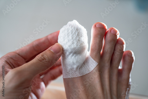 Canvas Print An injured toe with net bandage